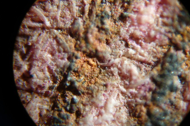 Pigment examination under microscope